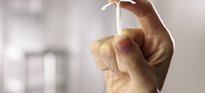 DIU Mirena – informações para conhecê-lo